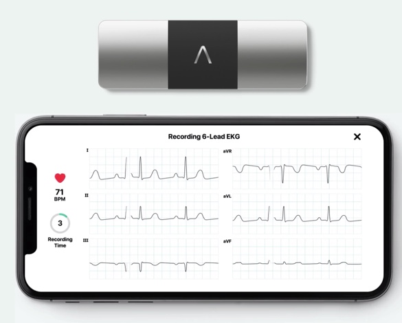 Episode 38, KardiaMobile 6L Heart Monitor, 6-Lead Device and iPhone App ...